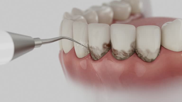 Trusted Tooth Extraction service in Normal, IL - Dentist Open Now